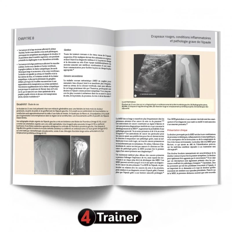 L'Épaule - 4TRAINER EDITIONS 7 L'Épaule - 4TRAINER EDITIONS - Image 7
