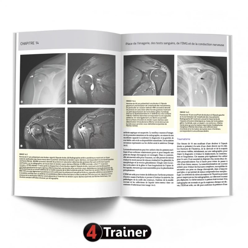 L'Épaule - 4TRAINER EDITIONS 9 L'Épaule - 4TRAINER EDITIONS - Image 9